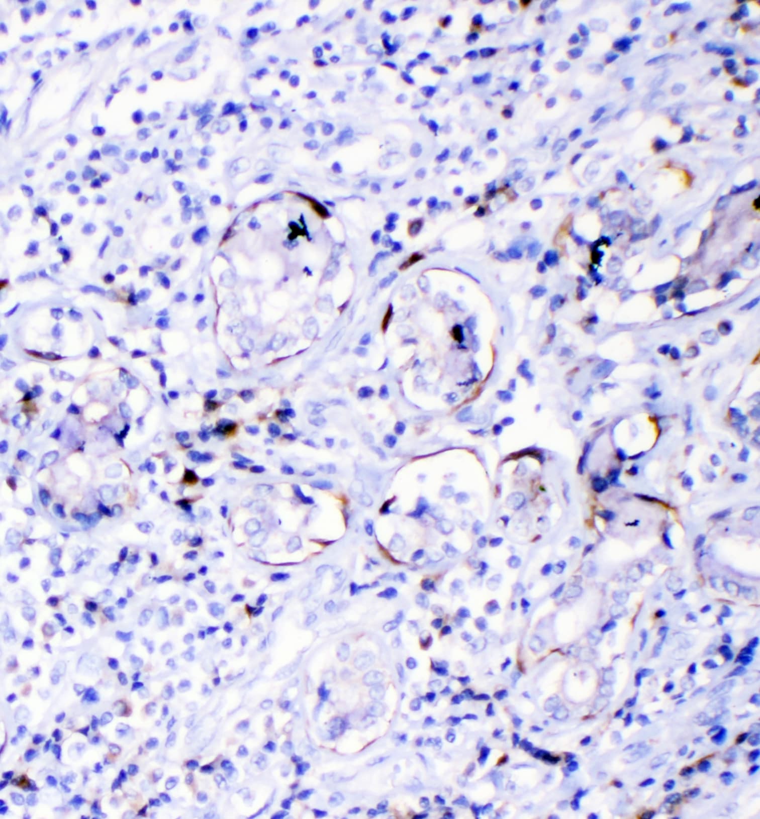 Polyclonal Rabbit anti-Human TNFSF15 / TL1A / VEGI Antibody (WB)