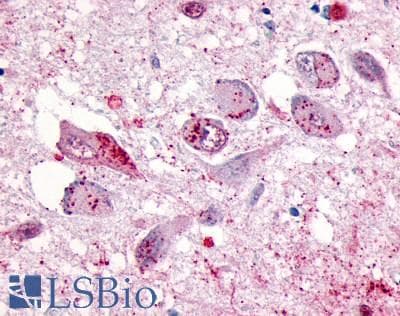 PathPlus™ ADGRD1 / GPR133 Antibody (Cytoplasmic Domain)