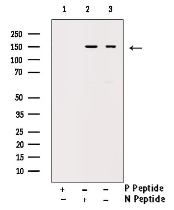 Polyclonal Rabbit anti-Human ERBB2 / HER2 Antibody (phospho-Tyr1112, IHC, IF, WB)