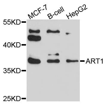 ART1 /CD296 Antibody