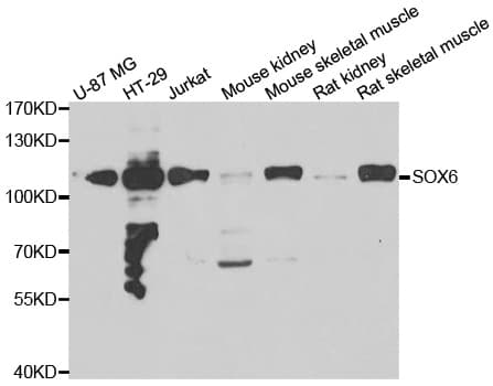 SOX6 Antibody