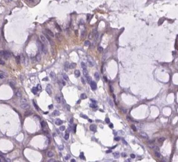 ITGB7 / Integrin Beta 7 Antibody