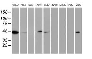 APMAP / C20orf3 Antibody (clone OTI4E2)
