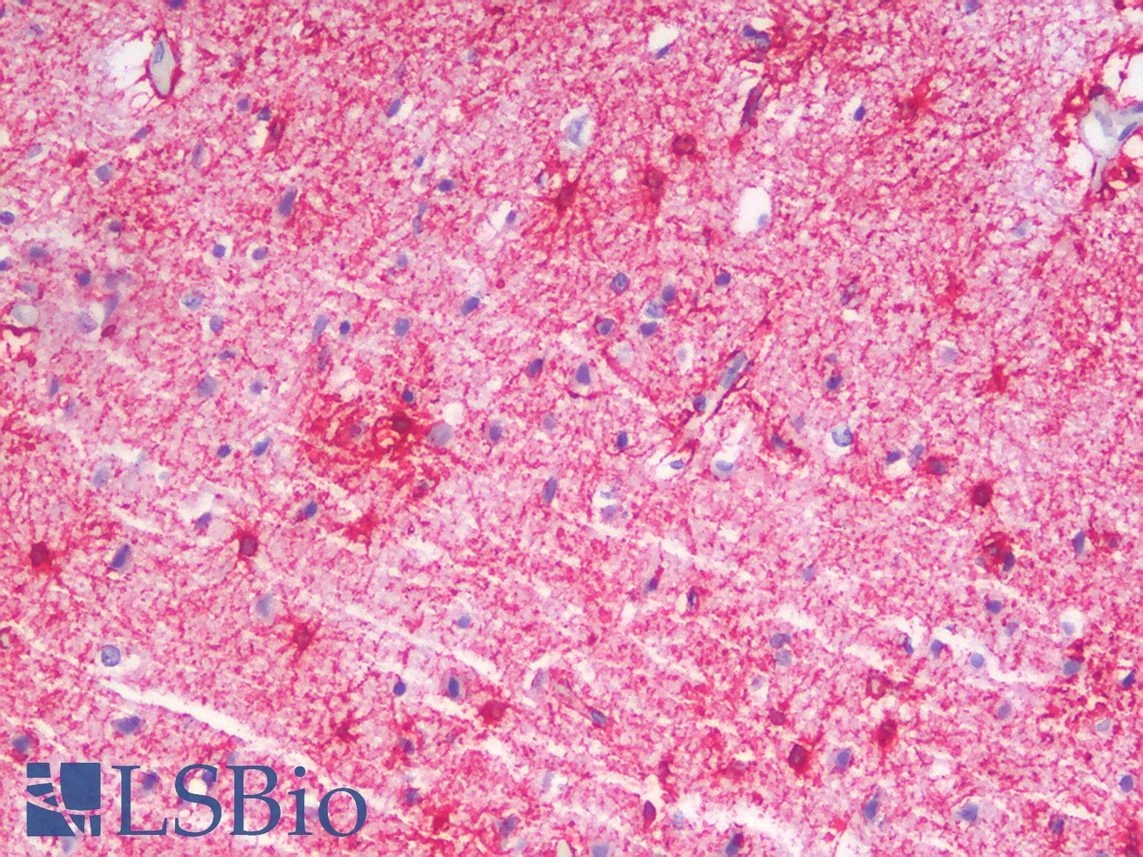 PathPlus™ Polyclonal Rabbit anti-Mouse GFAP Antibody (IHC, IF, WB)