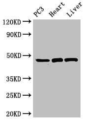 Polyclonal Rabbit anti-Human ARRB2 / Beta Arrestin 2 Antibody (IHC, IF, WB)