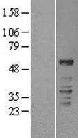 Human RORC / ROR Gamma Protein (Over-Expression Lysate Myc-DDK (Flag))