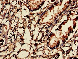 Polyclonal Rabbit anti-Human NUDT1 / MTH1 Antibody (IHC, IF)