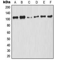 Polyclonal Rabbit anti-Human NFKB1 / NF-Kappa-B Antibody (phospho-Ser927, IHC, IF, WB)