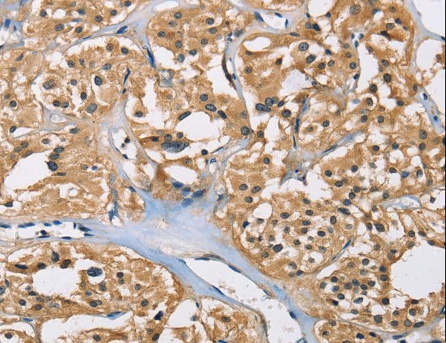 PPP3CA / CCN1 / Calcineurin A Antibody