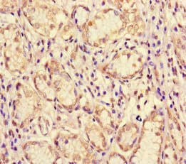 ME1 / Malate Dehydrogenase Antibody