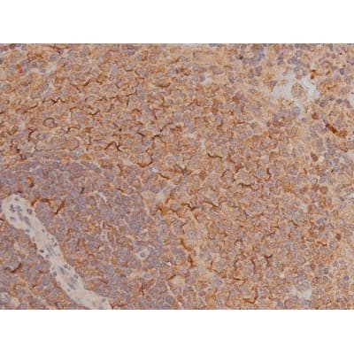 Polyclonal Rabbit anti-Human SP1 Antibody (phospho-Thr739, IHC, IF, WB)
