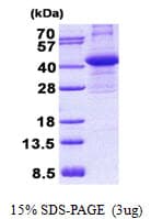 Human CIAPIN1 / Anamorsin Protein (Recombinant His)