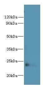 FAM156A / TMEM29 Antibody