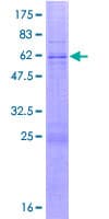 Human SLX1A / GIYD2 Protein (Recombinant GST)