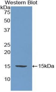 ADM / Adrenomedullin Antibody (aa27-184, Cy3)