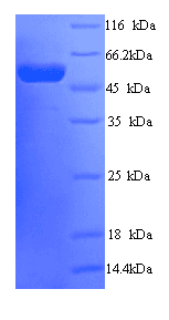 Human PPAN Protein (Recombinant His)