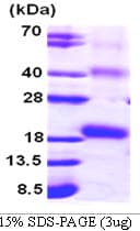 Human IL18 Protein (Recombinant His)