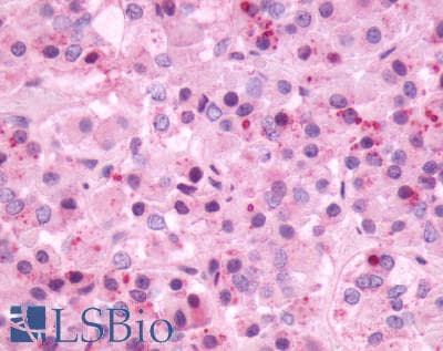 PathPlus™ NMBR Antibody (C-Terminus)