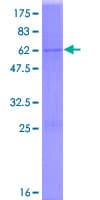 Human DHRS7B Protein (Recombinant GST)