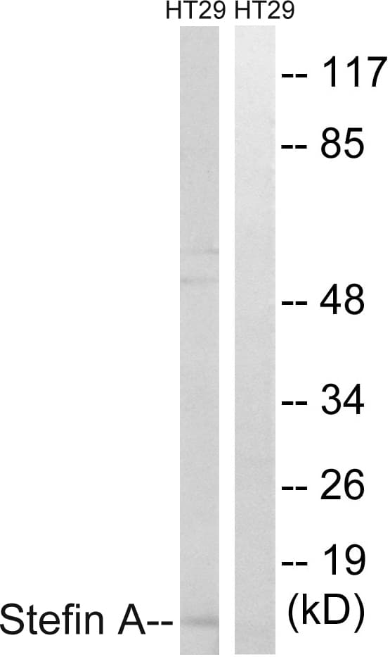 IHC-plus™ Polyclonal Rabbit anti-Human CSTA / Cystatin A Antibody (aa49-98, IHC, IF, WB)