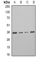 Polyclonal Rabbit anti-Human PARD6A / PAR6 Antibody (IHC, WB)