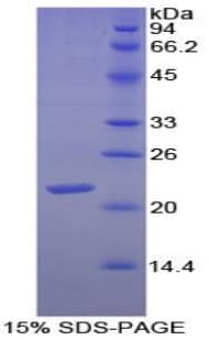 Chicken FN1 / Fibronectin Protein (Recombinant His)