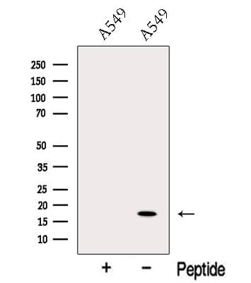 ODAM Antibody