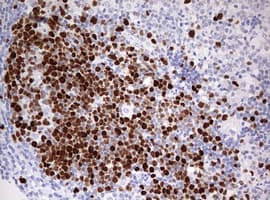 TOP2A / Topoisomerase II Alpha Antibody (aa1100-1531, clone 1D2, Carrier-free)