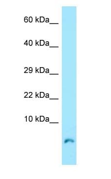 Polyclonal Rabbit anti-Human COX7A1 Antibody (aa8-57, WB)