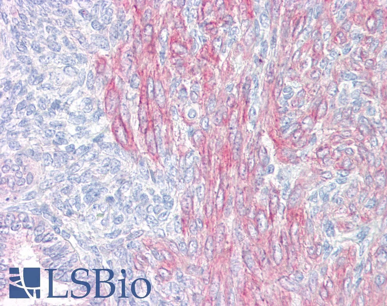 IHC-plus™ PAWR / PAR4 Antibody (aa291-340)