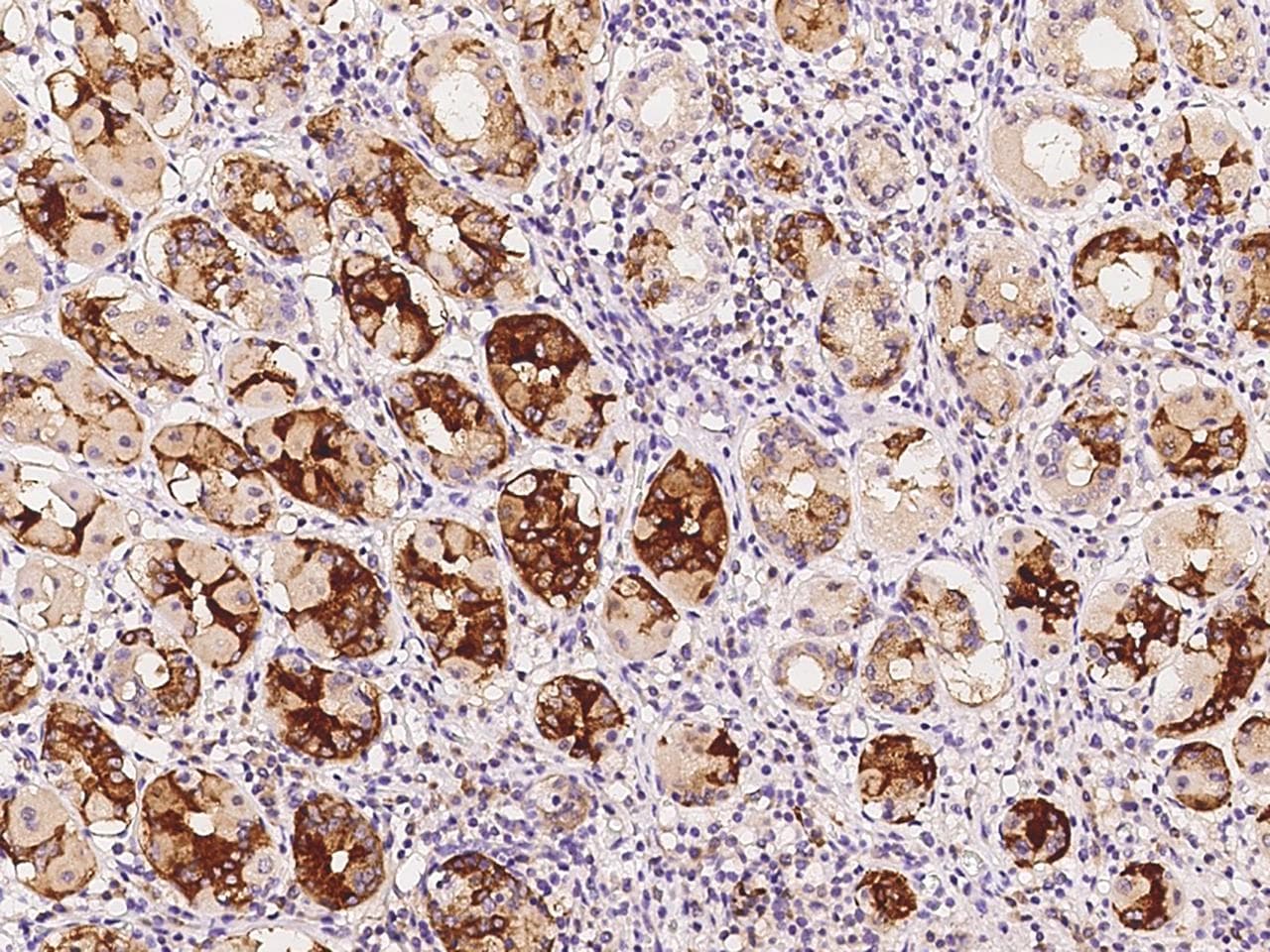UCKL1 Antibody