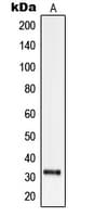 SLC25A21 / ODC1 Antibody (Internal)