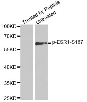 Polyclonal Rabbit anti-Human ER Alpha / Estrogen Receptor Antibody (phospho-Ser167, IHC, IF, WB)