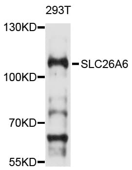 Polyclonal Rabbit anti-Human SLC26A6 / PAT1 Antibody (WB)
