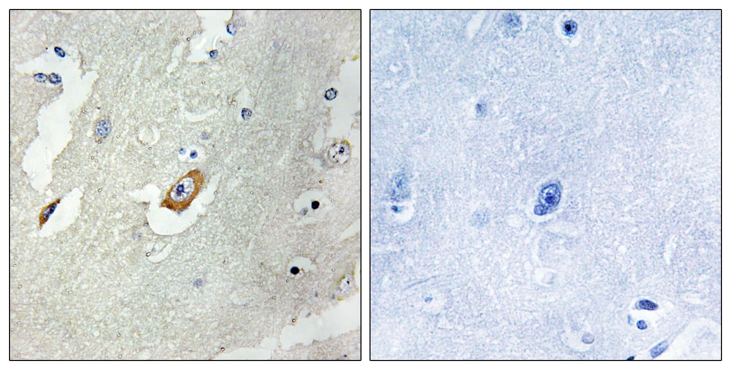 Polyclonal Rabbit anti-Human APC6 / CDC16 Antibody (aa526-575, IHC, WB)