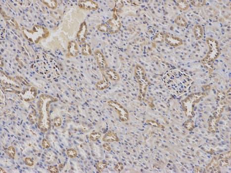 Polyclonal Rabbit anti-Human AP50 / AP2M1 Antibody (IHC, WB)