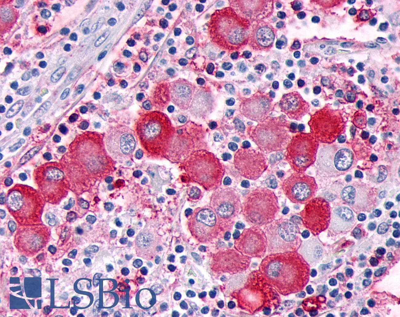PathPlus™ GPR63 Antibody (C-Terminus)