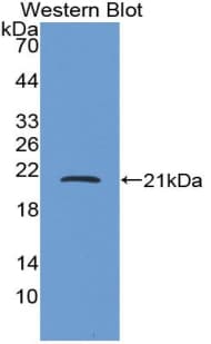 CRH / CRF Antibody (aa40-195)