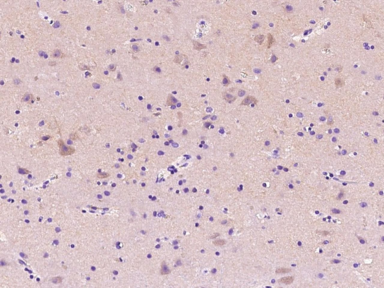 ADA / Adenosine Deaminase Antibody