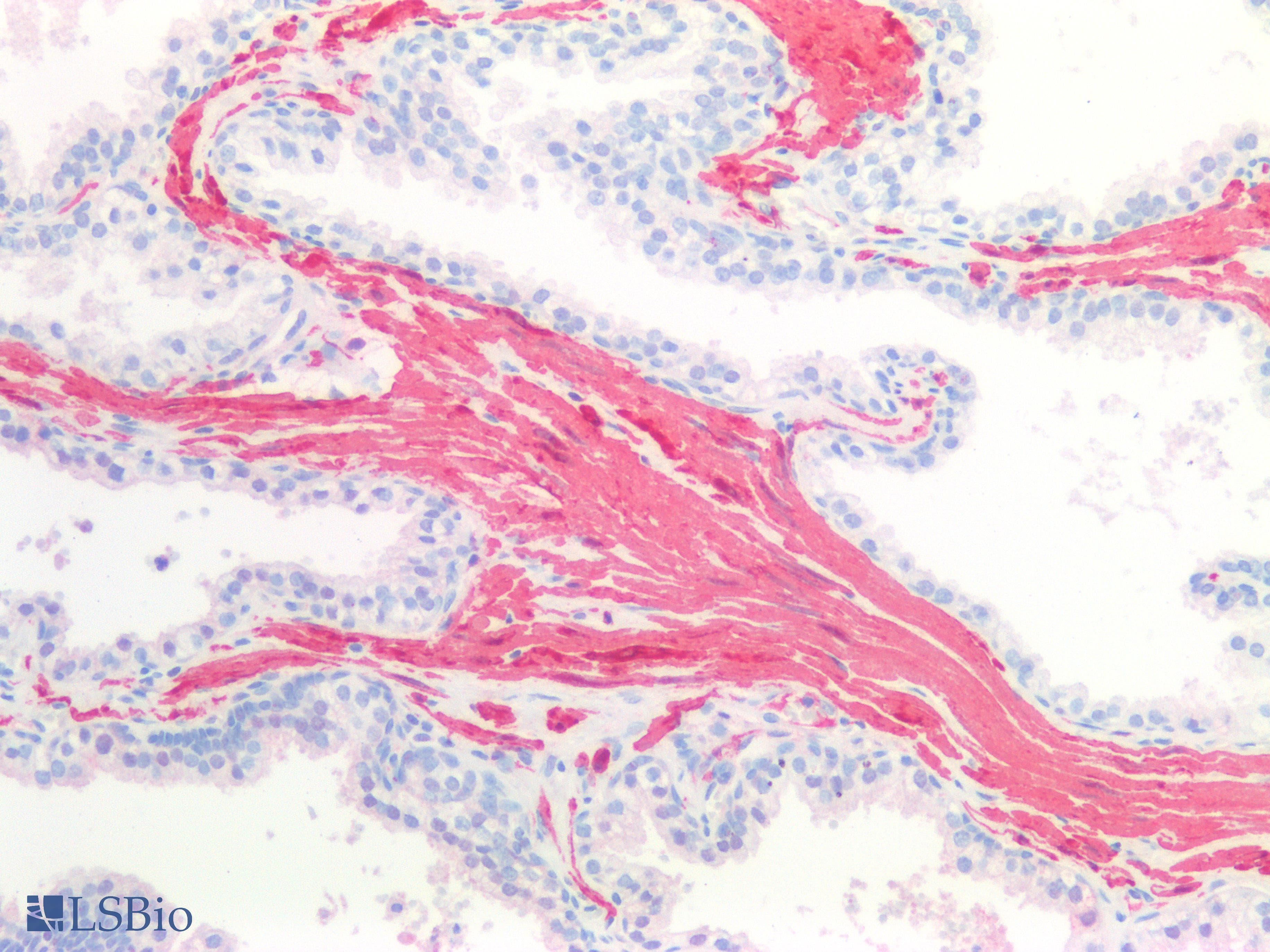 IHC-plus™ CNN1 / Calponin Antibody (clone 1H5B5)