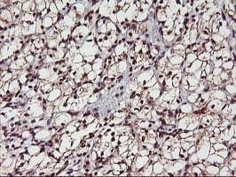 Monoclonal Mouse anti-Human MGLL / Monoacylglycerol Lipase Antibody (clone OTI1B1, IHC, IF, WB)