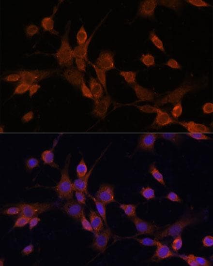 MAP2K3 / MEK3 / MKK3 Antibody