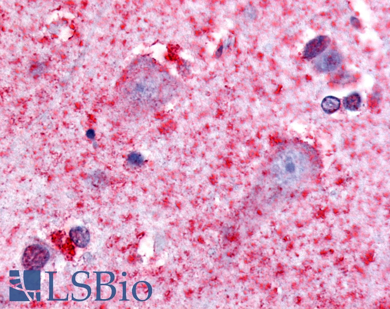 IHC-plus™ Polyclonal Rabbit anti-Human HTR7 / 5HT7 Receptor Antibody (Cytoplasmic Domain, IHC)