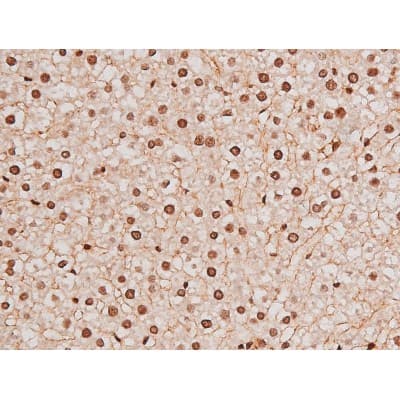 STAT3 Antibody (phospho-Tyr705)