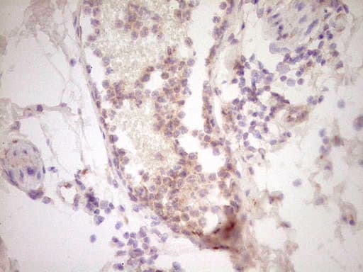 UBE2D2 / UBCH5B Antibody (clone OTI1A9)