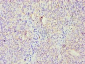 Polyclonal Rabbit anti-Human HBP17 / FGFBP1 Antibody (aa22-232, IHC)