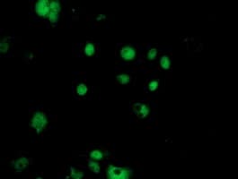 NUDT18 Antibody (clone OTI1A5)