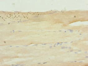 SH2B1 Antibody