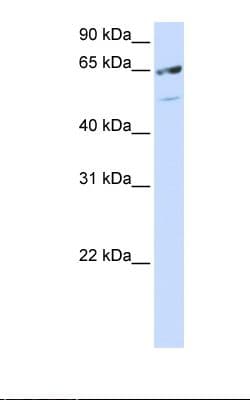 Polyclonal Rabbit anti-Human SRSF11 / SFRS11 Antibody (aa398-447, IHC, WB)