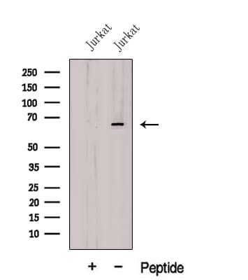 Polyclonal Rabbit anti-Human CBFA2T3 Antibody (IF, WB)
